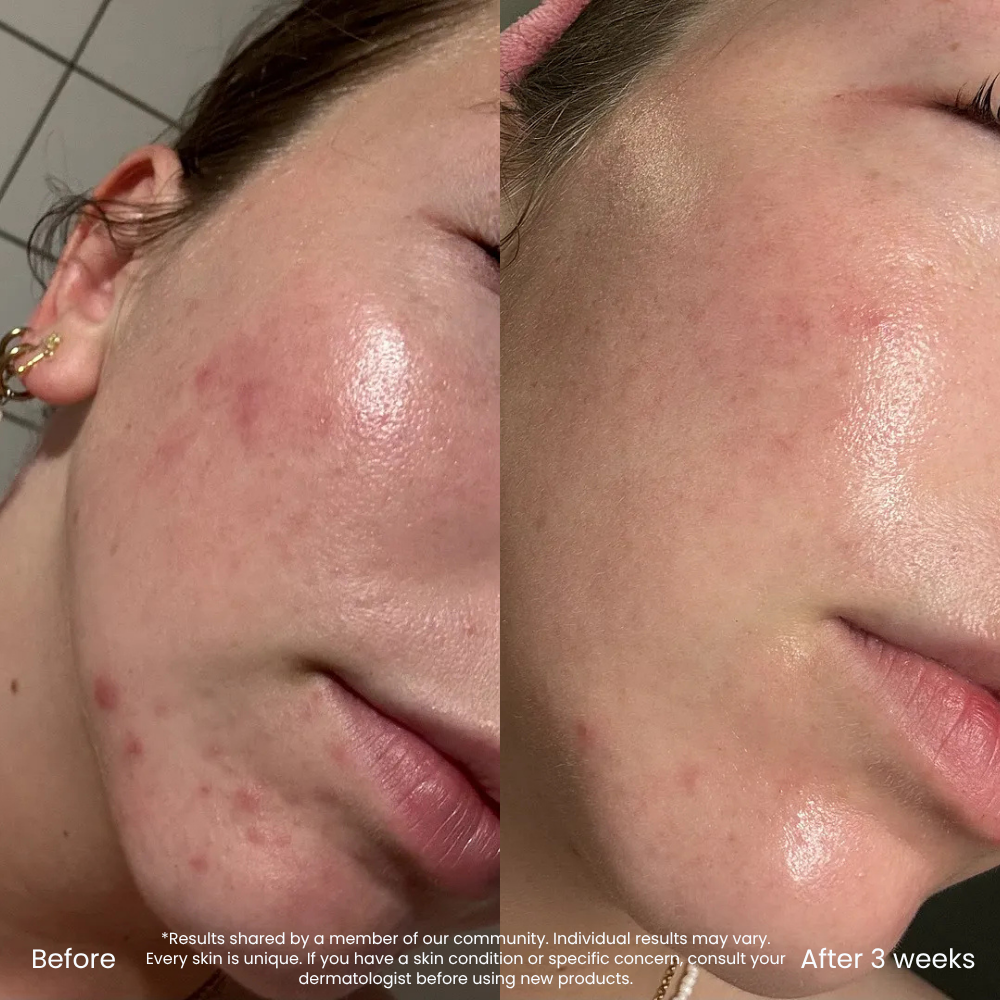 Niacinamide Clear Skin Serum