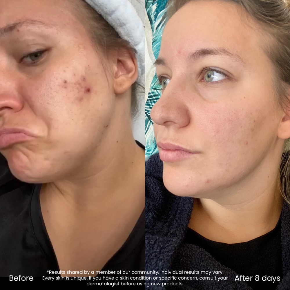 The Bestselling Glow & Renewal Routine