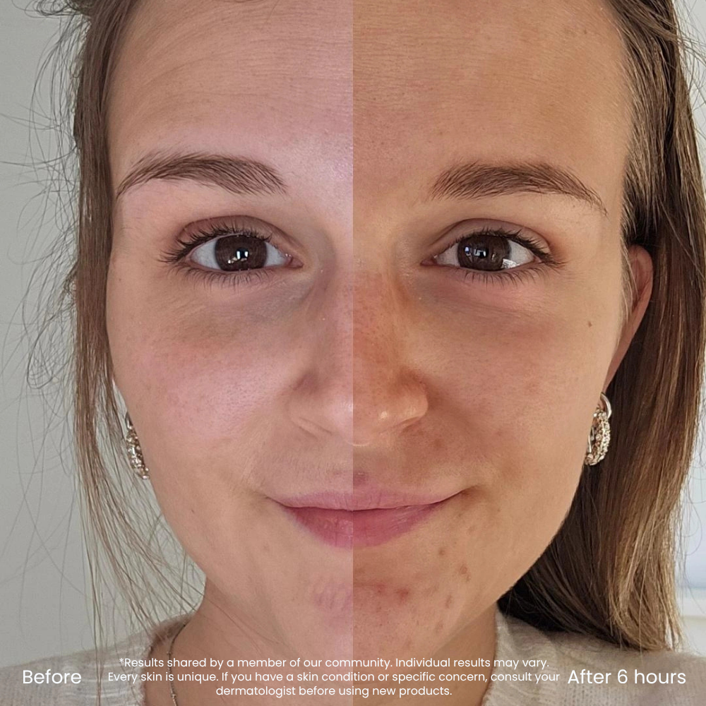 Hyaluronic Acid Self Tan Drops For A Natural Glow