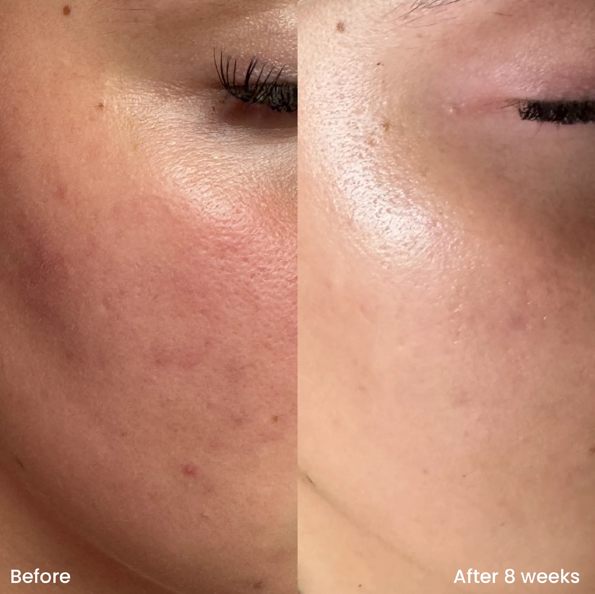 Barrier repair serum