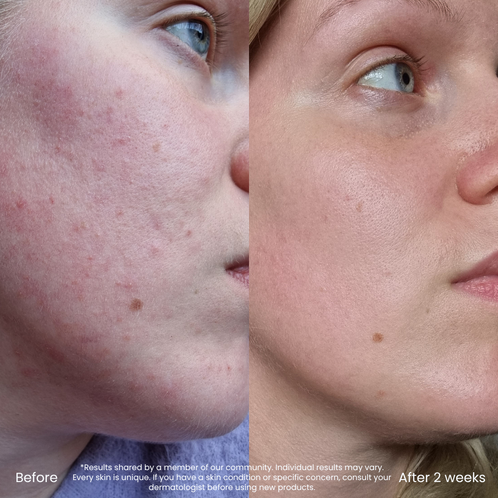 Hyaluronic Acid Hydrating Toner For Dry & Dehydrated Skin