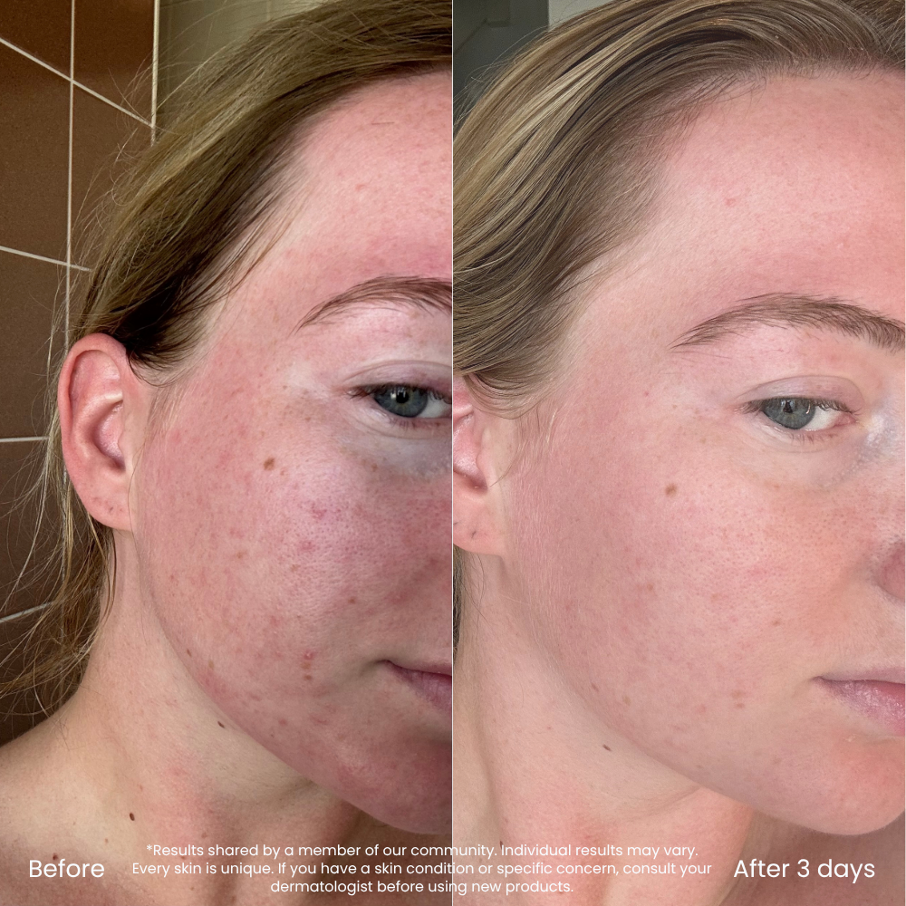 Foam Micellar Makeup Remover Is Gentle & Hydrating