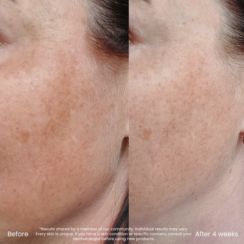 Dark Spot & Redness Correcting Vitamin C Serum
